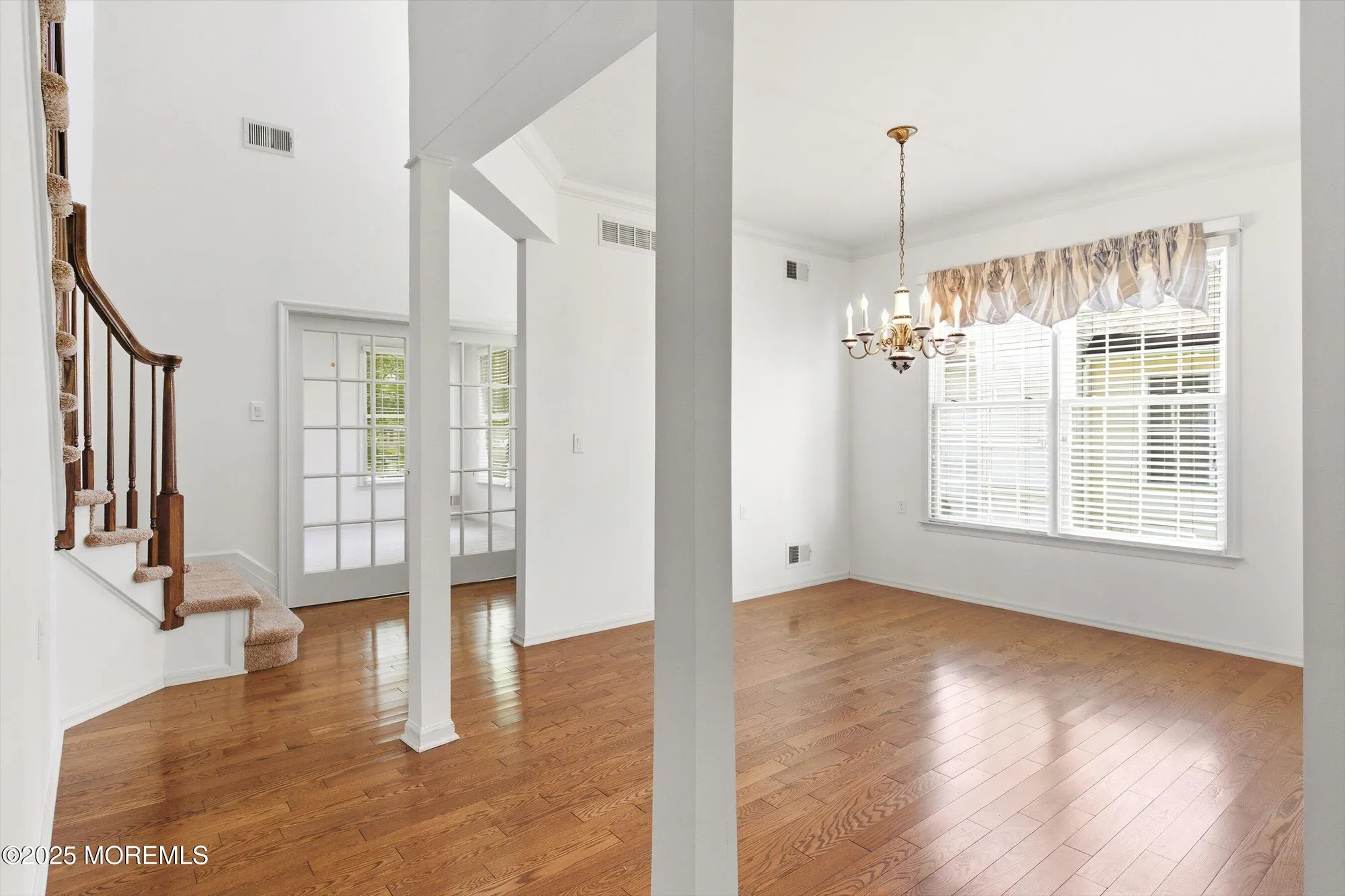 Property Slideshow image 7 of 45 | 11 rolling meadows blvd, Asbury Park, NJ, 07712
