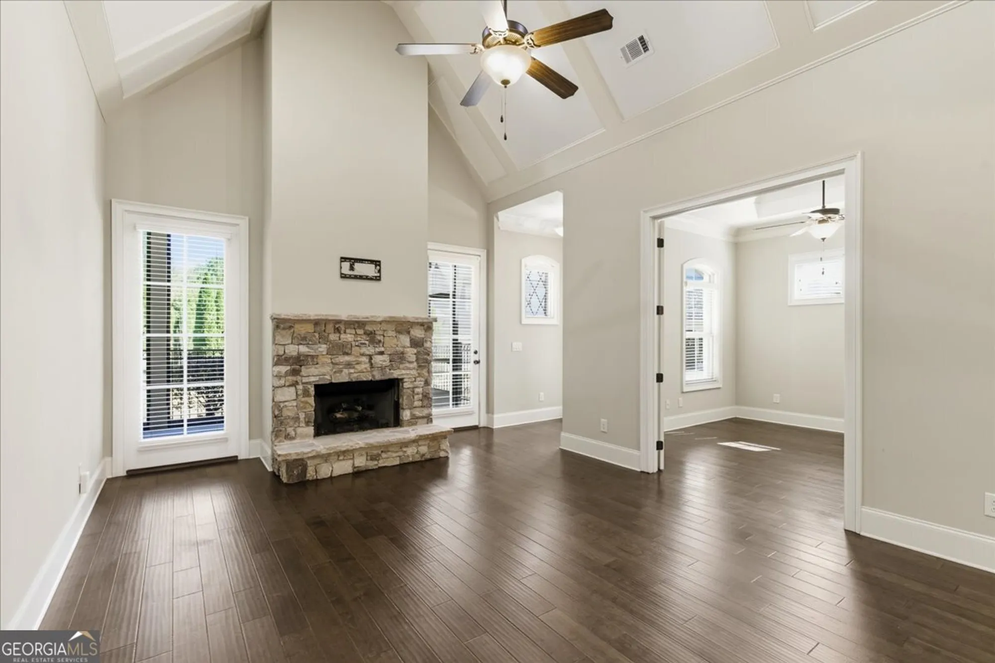 Property Slideshow image 8 of 27 | 64 cedarcrest village ct, Acworth, GA, 30101