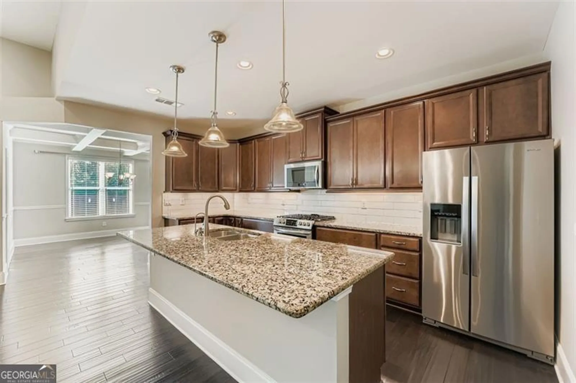 Property Slideshow image 14 of 29 | 313 derrymore dr, Woodstock, GA, 30188