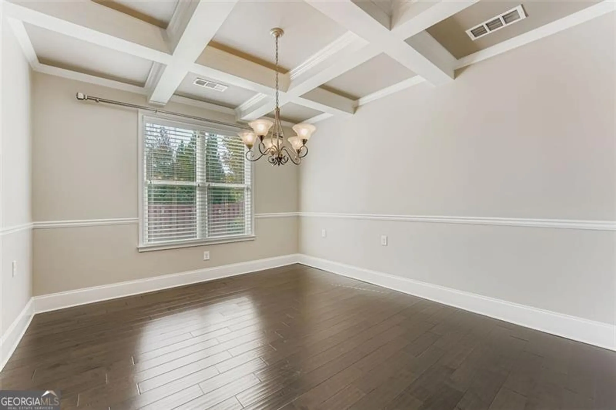 Property Slideshow image 11 of 29 | 313 derrymore dr, Woodstock, GA, 30188