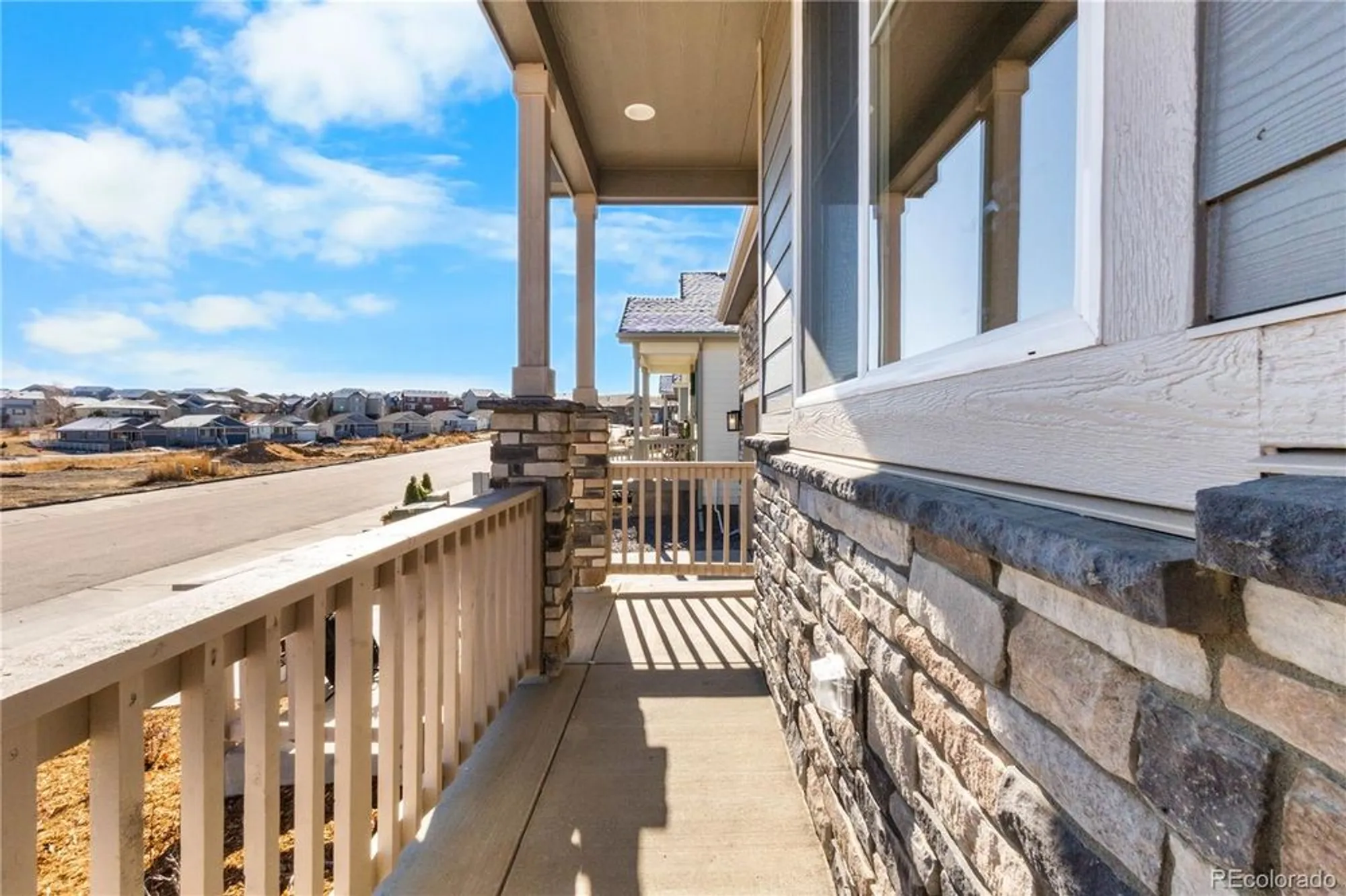 Property Slideshow image 5 of 48 | 4515 westlock st, Castle Rock, CO, 80104