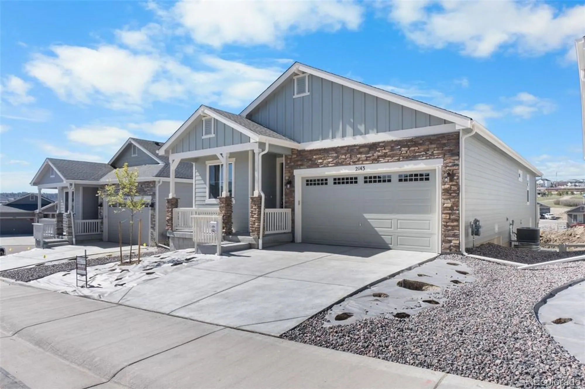 Property Slideshow image 4 of 37 | 4515 westlock st, Castle Rock, CO, 80104