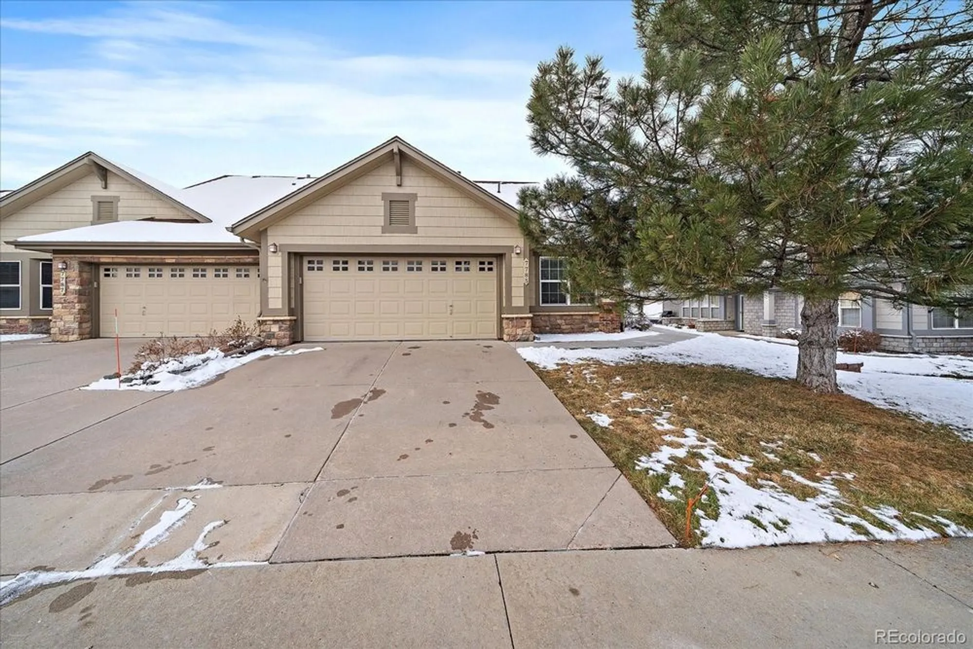 Property Slideshow image 22 of 25 | 7785 s biloxi way, Aurora, CO, 80016